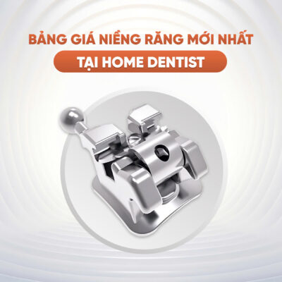 Bảng giá niềng răng