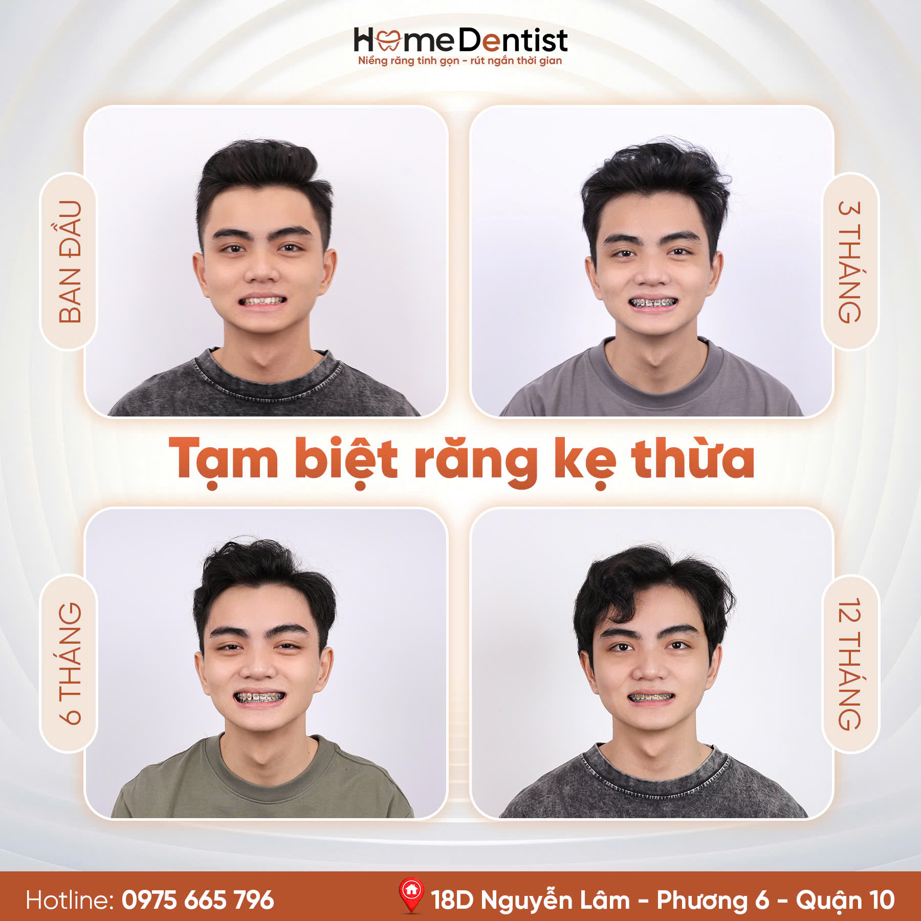 Niềng răng kẹ thừa cùng bác sĩ Huỳnh Đức