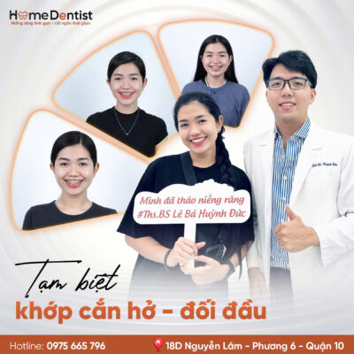 Tháo niềng răng cùng bác sĩ Huỳnh Đức