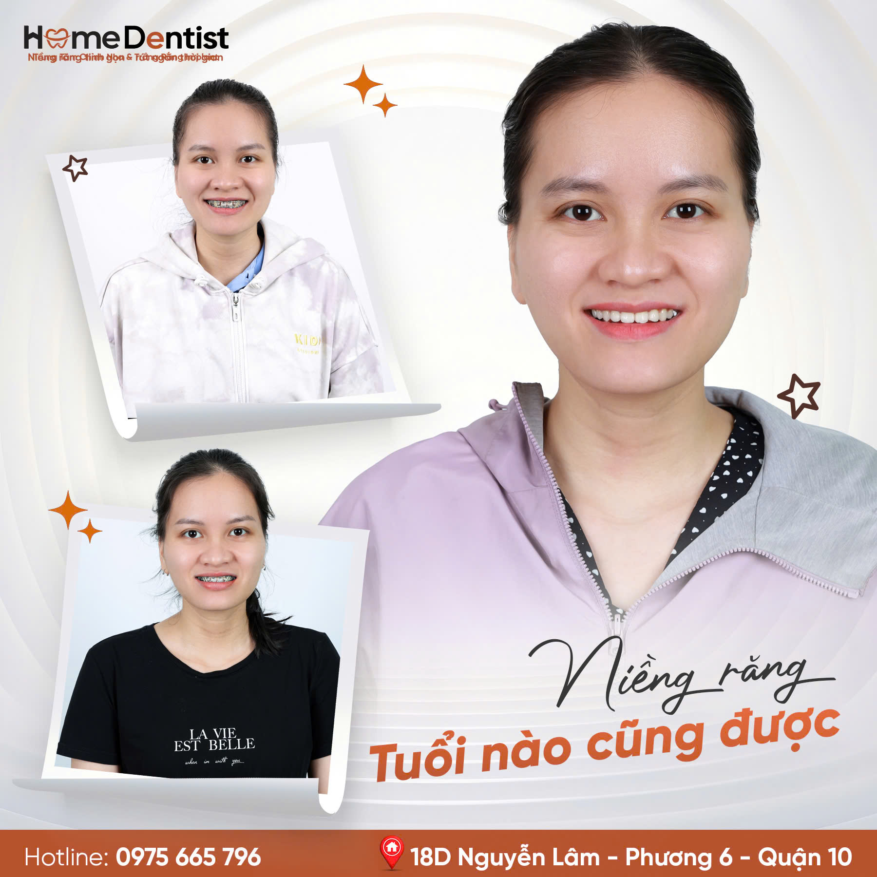Thay đổi nụ cười sau niềng răng cùng BS Huỳnh Đức