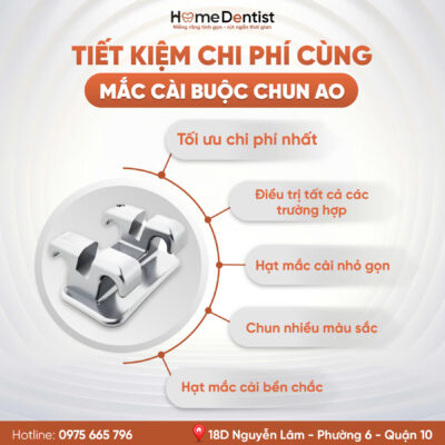 Tối ưu chi phí cùng kim loại buộc chun AO