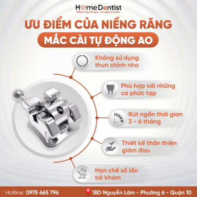 Ưu điểm mắc cài tự động AO